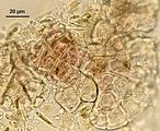 1 - Disco germinativo